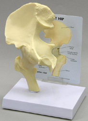 Hip Joint Pharmaceutical and Anatomical Model Gifts